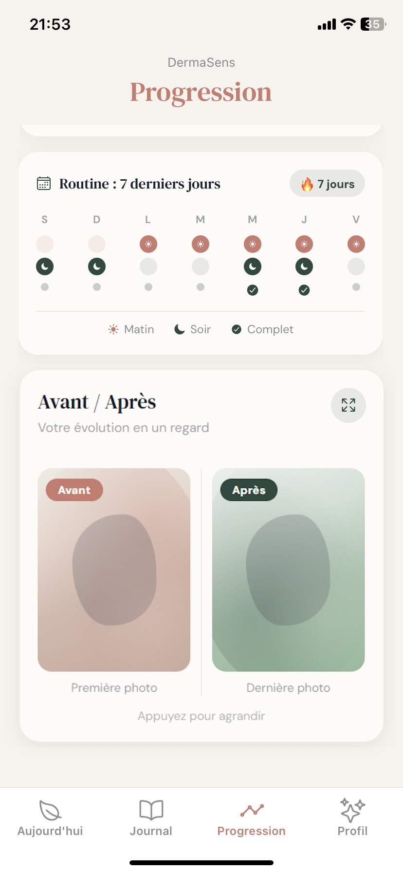 Comparaison avant/après